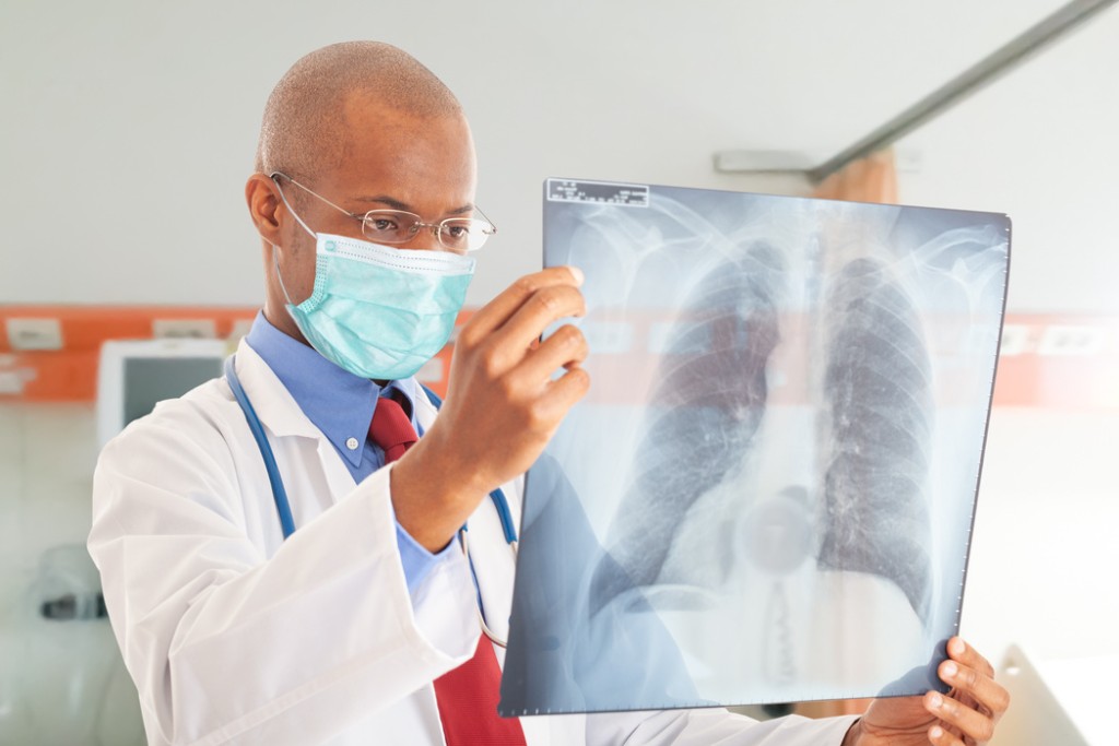 Doctor examining a chest X-ray in a clinical setting